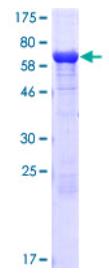 SDS-PAGE (ETF1-3514H).jpg